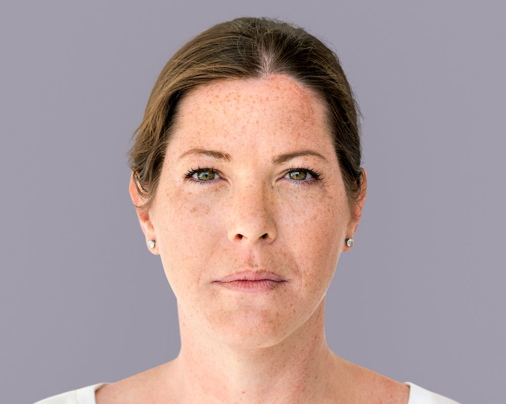 acne in menopausa