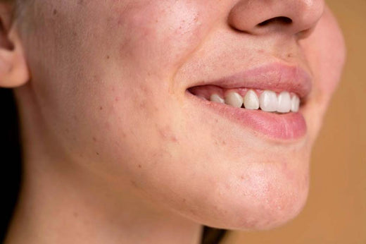 Macchie sulla pelle: quali sono le cause