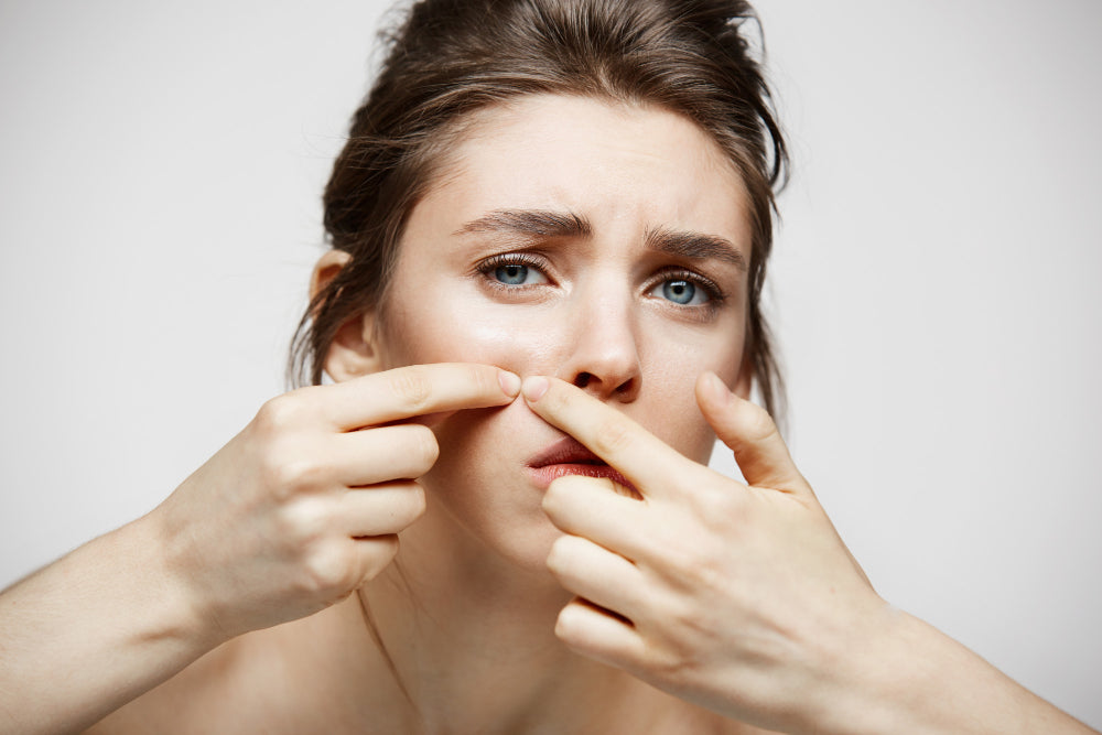 Come Eliminare i Punti Neri: Consigli Efficaci per una Pelle Perfetta