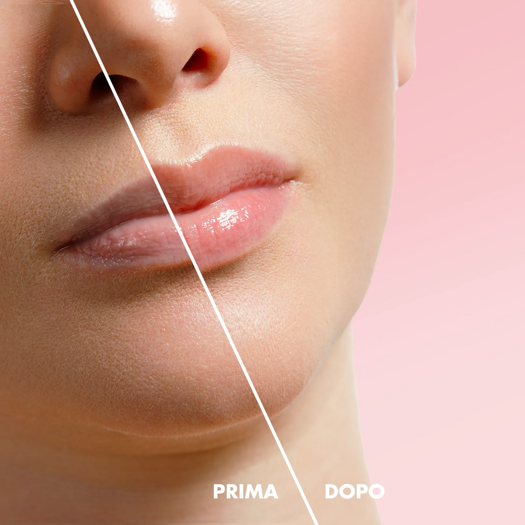 Gloss labbra volumizzante